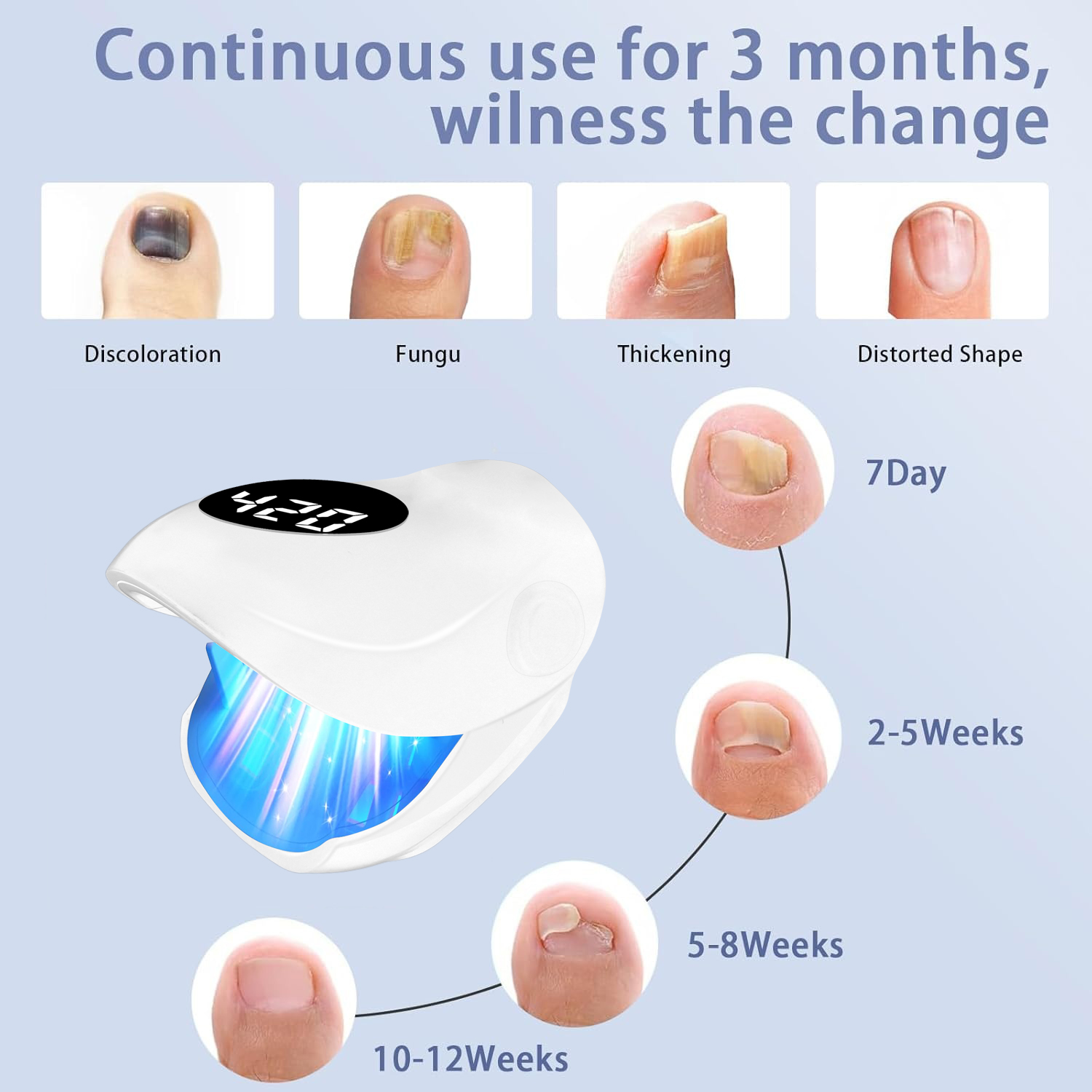 Лазерное устройство грибка ног – обзор и цена Galvanic Skin Sensor
